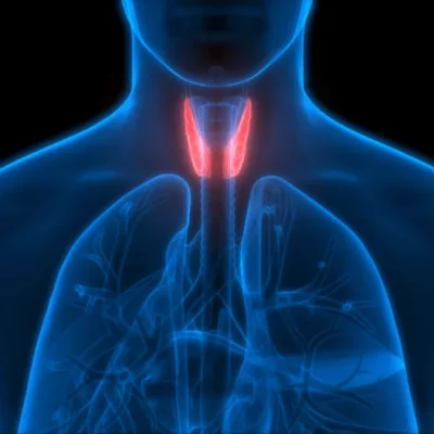 Hypothyroidism
