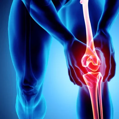 Osteoarthritis